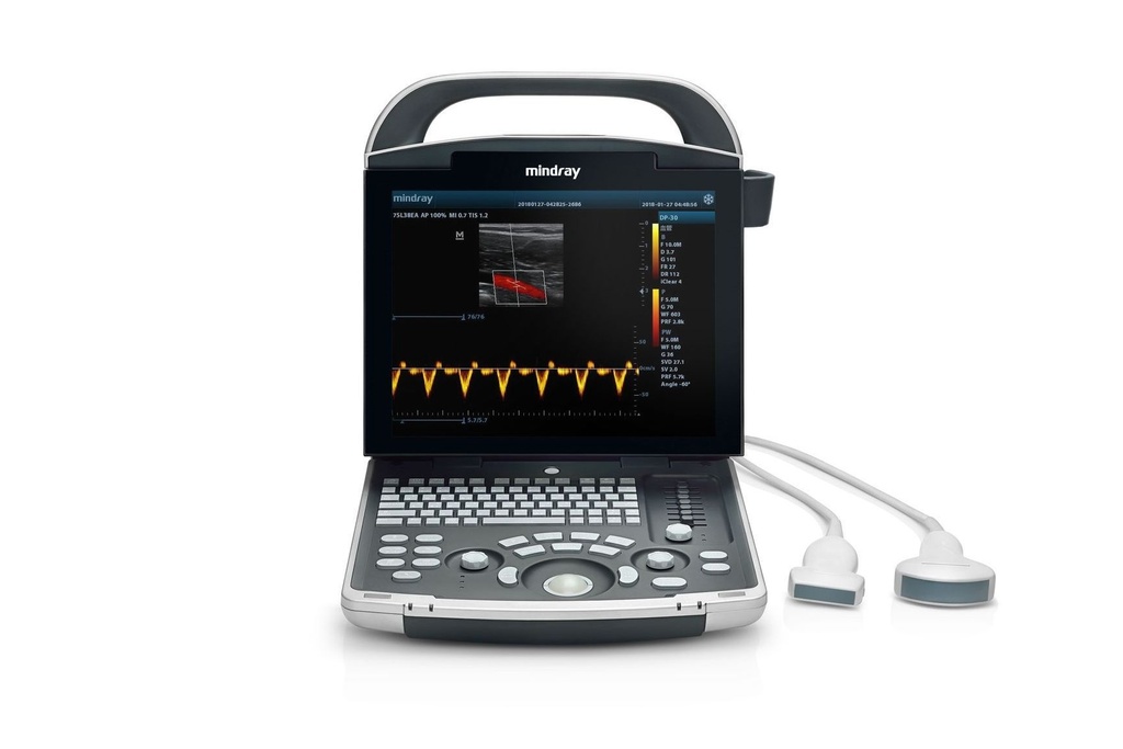 Mindray DP-30 Ultraschallsystem