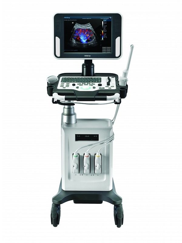 Mindray DC-30 Ultraschallsystem