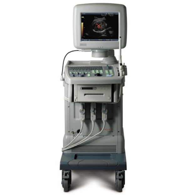 Medison SonoAce SA-8000SE Ultraschallsystem