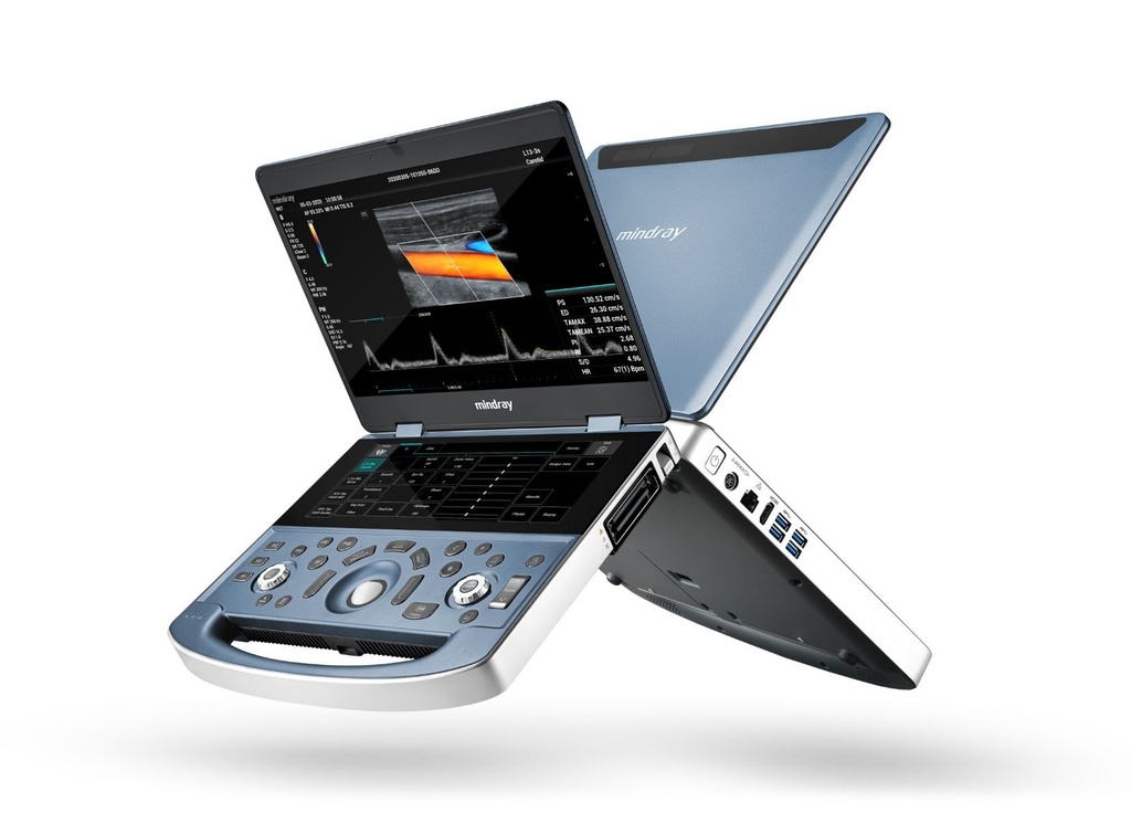 Mindray MX7 Ultraschallsystem