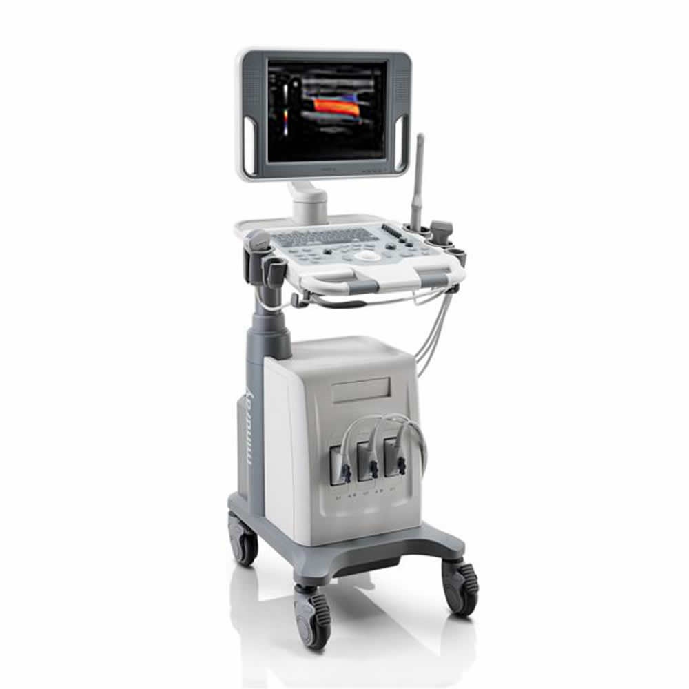 Mindray DC N2 Ultraschallsystem