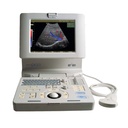 Medison SonoAce Pico Ultraschallsystem