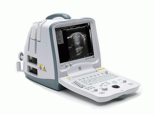 Mindray DP-6900 Ultraschallsystem