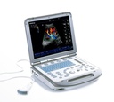 Mindray M5 Ultraschallsystem