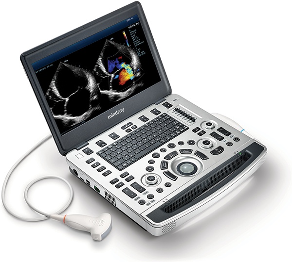 Mindray M8 Ultraschallsystem