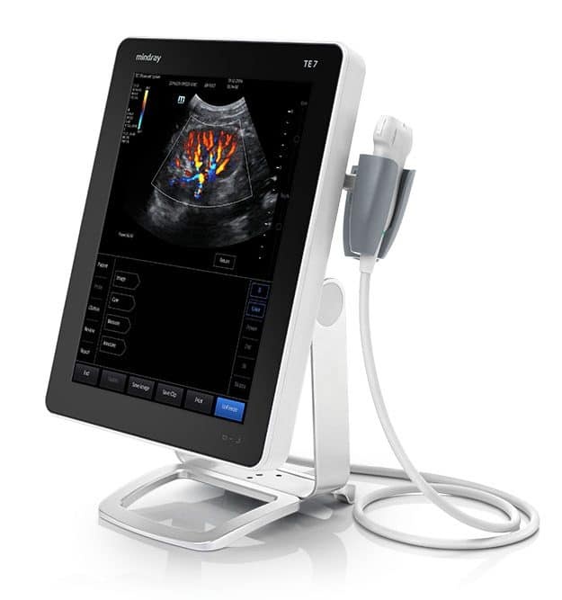 Mindray TE7 Ultraschallsystem
